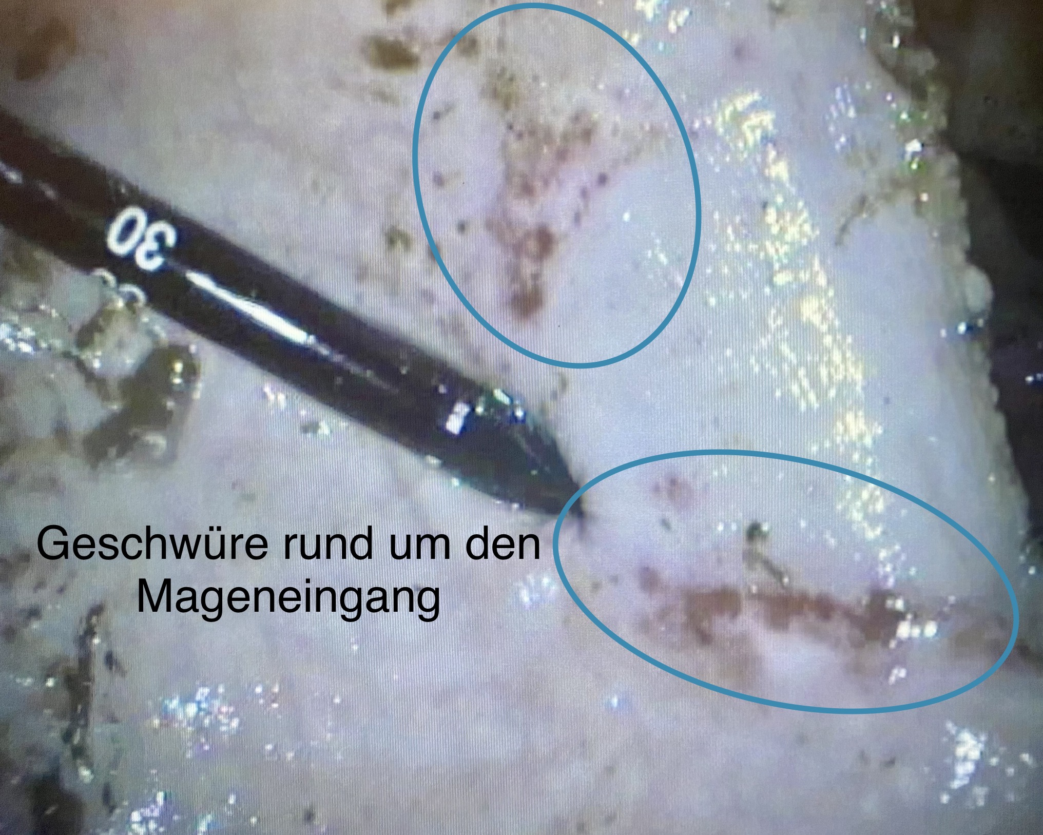 Gastroskopie Pferdedocs