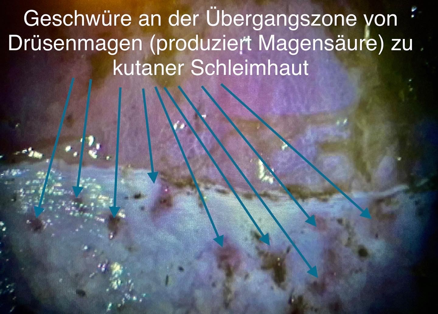 Gastroskopie Pferdedocs