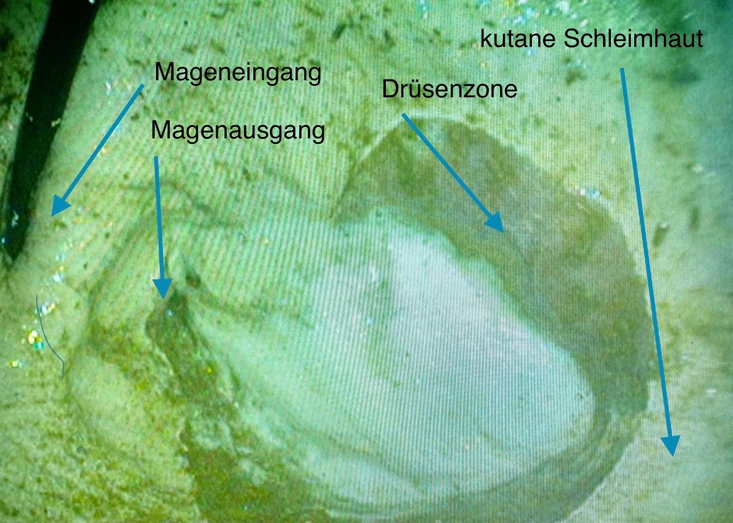 Gastroskopie Pferdedocs